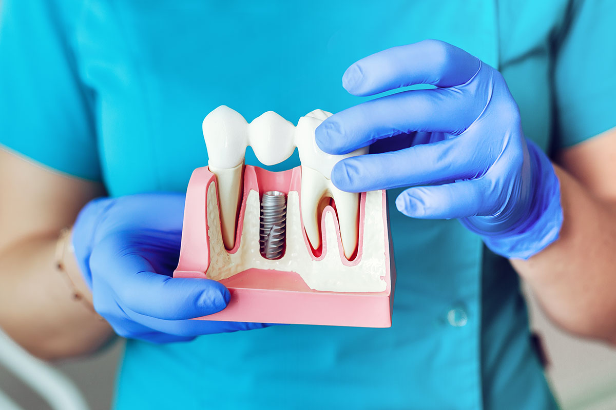 close-up-dental-implant-model-hands-dentist-holding-implant Happy child at dental clinic in Scarborough receiving gentle dental care