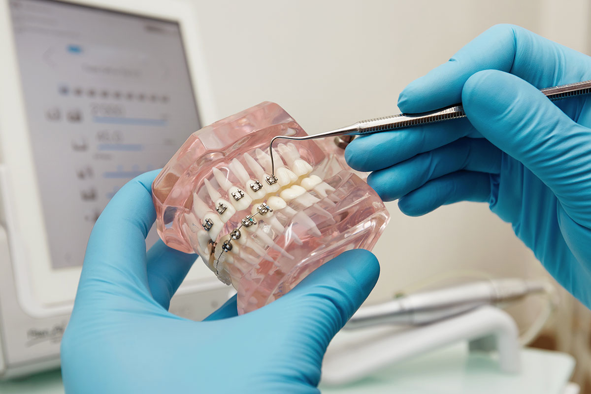 dentist-holding-dental-plastic-model-with-braces Happy child at dental clinic in Scarborough receiving gentle dental care
